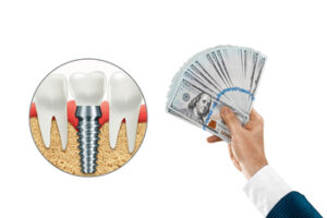 inexpensive dental implant sydney
