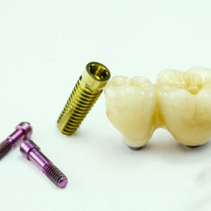 low cost teeth implant sydney